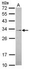 Polypeptide N-Acetylgalactosaminyltransferase 12 antibody, NBP2-16594, Novus Biologicals, Western Blot image 