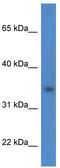 Hydroxysteroid Dehydrogenase Like 1 antibody, TA343008, Origene, Western Blot image 