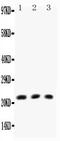 Lymphotoxin Alpha antibody, LS-C343881, Lifespan Biosciences, Western Blot image 