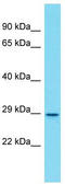 Olfactory receptor 872 antibody, TA334340, Origene, Western Blot image 