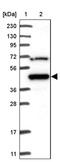 Makorin Ring Finger Protein 2 antibody, PA5-58005, Invitrogen Antibodies, Western Blot image 