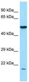Ras-related protein Rab-7L1 antibody, TA331289, Origene, Western Blot image 