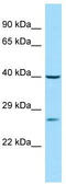 Phosphatidylserine Decarboxylase antibody, TA338091, Origene, Western Blot image 