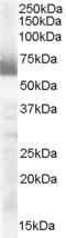 Cytochrome P450 Family 17 Subfamily A Member 1 antibody, EB07219, Everest Biotech, Western Blot image 