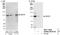 ATP Binding Cassette Subfamily F Member 1 antibody, NBP1-18888, Novus Biologicals, Western Blot image 