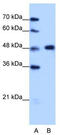 Heterogeneous Nuclear Ribonucleoprotein F antibody, TA345903, Origene, Western Blot image 