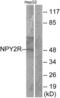 Neuropeptide Y Receptor Y2 antibody, abx015351, Abbexa, Western Blot image 