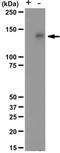 MET antibody, NBP2-29685, Novus Biologicals, Western Blot image 