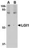 Leucine Rich Glioma Inactivated 1 antibody, orb74960, Biorbyt, Western Blot image 