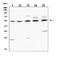 Acetylcholine Receptor antibody, PA2202, Boster Biological Technology, Western Blot image 