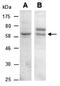 IKAROS Family Zinc Finger 2 antibody, orb67010, Biorbyt, Western Blot image 