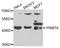 Protein Arginine Methyltransferase 6 antibody, STJ110124, St John