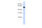 Centrosomal Protein 55 antibody, 26-122, ProSci, Enzyme Linked Immunosorbent Assay image 