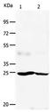 Fibroblast Growth Factor 7 antibody, orb107476, Biorbyt, Western Blot image 