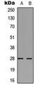 Troponin I3, Cardiac Type antibody, LS-C358370, Lifespan Biosciences, Western Blot image 