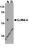Inducible T Cell Costimulator Ligand antibody, 8687, ProSci, Western Blot image 