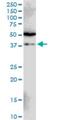 Siah E3 Ubiquitin Protein Ligase 1 antibody, H00006477-M02, Novus Biologicals, Western Blot image 