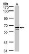 Glucose-6-Phosphate Dehydrogenase antibody, PA5-27359, Invitrogen Antibodies, Western Blot image 