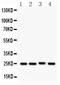 Suppressor Of Cytokine Signaling 3 antibody, PB9401, Boster Biological Technology, Western Blot image 