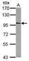 SPT20 Homolog, SAGA Complex Component antibody, PA5-28049, Invitrogen Antibodies, Western Blot image 