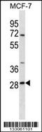 SRP Receptor Subunit Beta antibody, 58-261, ProSci, Western Blot image 