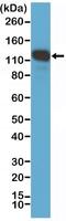 Melanoma Cell Adhesion Molecule antibody, NBP2-61563, Novus Biologicals, Western Blot image 