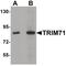 Tripartite Motif Containing 71 antibody, PA5-21011, Invitrogen Antibodies, Western Blot image 