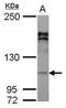 Adaptor Related Protein Complex 2 Subunit Alpha 2 antibody, PA5-29528, Invitrogen Antibodies, Western Blot image 