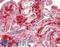 Coronin 1B antibody, LS-C784934, Lifespan Biosciences, Immunohistochemistry paraffin image 