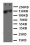 Zinc Finger E-Box Binding Homeobox 2 antibody, LS-C313494, Lifespan Biosciences, Western Blot image 