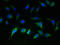 Solute Carrier Family 25 Member 36 antibody, LS-C378980, Lifespan Biosciences, Immunofluorescence image 