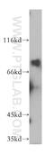 Dymeclin antibody, 12001-1-AP, Proteintech Group, Western Blot image 