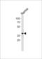 PHD Finger Protein 11 antibody, 61-015, ProSci, Western Blot image 