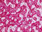 Dishevelled Associated Activator Of Morphogenesis 2 antibody, MBS248194, MyBioSource, Immunohistochemistry paraffin image 