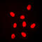 Mitogen-Activated Protein Kinase 6 antibody, LS-C354065, Lifespan Biosciences, Immunofluorescence image 