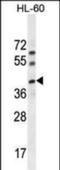 BLOC-1 Related Complex Subunit 6 antibody, MBS6004199, MyBioSource, Western Blot image 