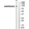 Ankyrin Repeat Domain 20 Family Member A3 antibody, A19555, Boster Biological Technology, Western Blot image 