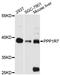 Protein Phosphatase 1 Regulatory Subunit 7 antibody, A13041, ABclonal Technology, Western Blot image 