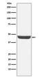 N-Myc Downstream Regulated 1 antibody, M01327-1, Boster Biological Technology, Western Blot image 