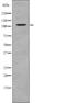 EPH Receptor A5 antibody, abx215182, Abbexa, Western Blot image 