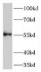 Transmembrane Protein 175 antibody, FNab08760, FineTest, Western Blot image 