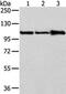 Adaptor Related Protein Complex 2 Subunit Alpha 1 antibody, CSB-PA995615, Cusabio, Western Blot image 