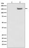 Structural maintenance of chromosomes protein 1A antibody, MP02148, Boster Biological Technology, Western Blot image 