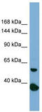RAD50 Double Strand Break Repair Protein antibody, TA332052, Origene, Western Blot image 