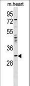 Orthopedia Homeobox antibody, LS-C158514, Lifespan Biosciences, Western Blot image 