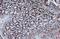Isocitrate Dehydrogenase (NADP(+)) 1, Cytosolic antibody, GTX105179, GeneTex, Immunohistochemistry paraffin image 