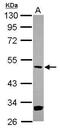 Mitogen-Activated Protein Kinase Kinase 5 antibody, GTX111129, GeneTex, Western Blot image 