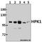 Mitogen-Activated Protein Kinase Kinase Kinase Kinase 1 antibody, A07909, Boster Biological Technology, Western Blot image 