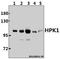 Mitogen-activated protein kinase kinase kinase kinase 1 antibody, A07909, Boster Biological Technology, Western Blot image 