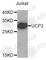 Uncoupling Protein 2 antibody, A4178, ABclonal Technology, Western Blot image 